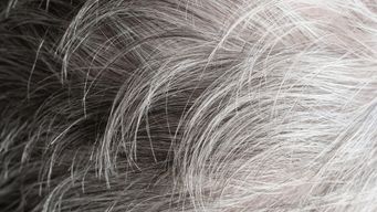 Grey hairs grow when your body shuts down cancer-prone cells, study suggests