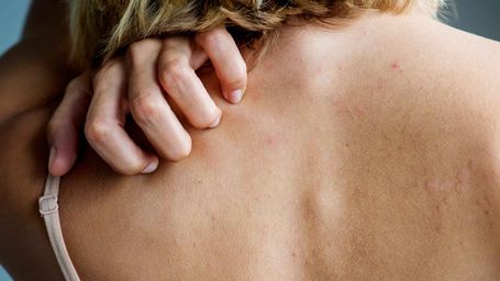 3D-Printed Skin That Stretches and Bleeds Just Like the Real Thing