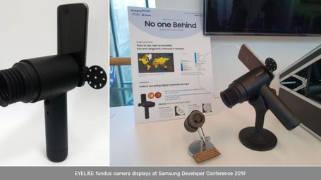 Samsung’s EYELIKE™ Fundus Camera Repurposes Galaxy Smartphones To Improve Access To Eye Care