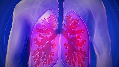 "Ya no hay motivos para posponer el cribado del cáncer de pulmón en España", gracias a la evidencia científica