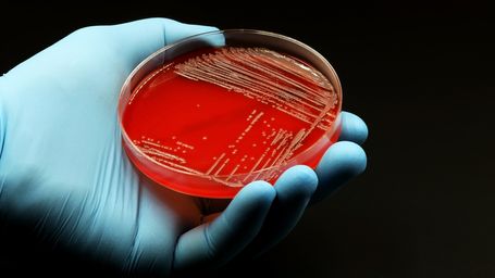 Not hydrogen, not electricity, but bacteria: The strangest fuel on the verge of development
