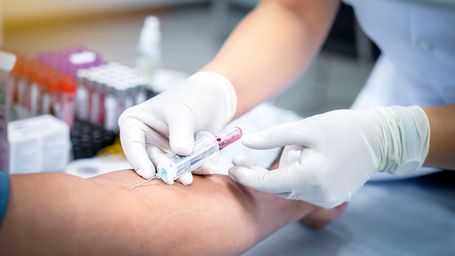 Labcorp launches blood test to accelerate Alzheimer’s diagnosis
