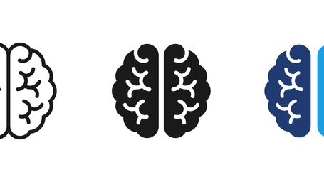 Wanted: Brain Trust to Support Employee Ownership Trust (EOT) Transactions