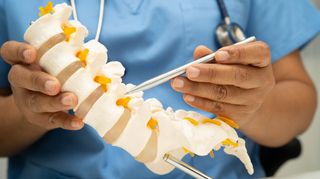 When a Missed Diagnosis Changes Everything: Delayed Treatment of Spinal Epidural Abscess