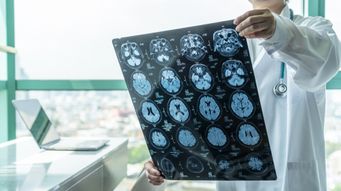 Therapeutic Drugs and the Blood Brain Barrier: How to Break on Through to the Other Side