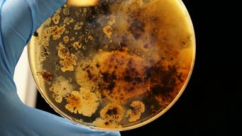 An Untapped Natural Treasure Trove of Viruses to Treat Drug-Resistant Bacterial Infections