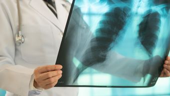 First Florida Tuberculosis-Tainted Surgical Case Among the Latest Filed Against Aziyo Biologics, Inc.