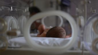 Revolutionary brain imaging technology could transform early diagnosis in neonatal brain injury cases