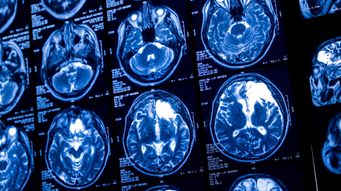 Your brain on trial - cognitive biases in dispute resolution