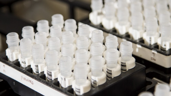 New blood test to guide personalized cancer treatment