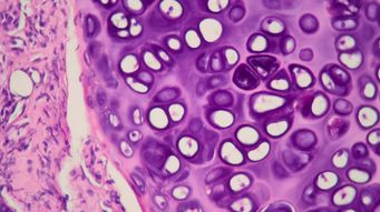 Revolutionizing Cancer Treatment with Digital Pathology Predictions