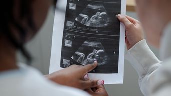 Neonatal care leave and pay: what UK employers need to know about the new statutory right