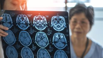 Understanding Brain Injuries and Medical Malpractice: Your Rights and Options