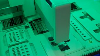 AI Predicts Aggressiveness of Early Stage Breast Cancer
