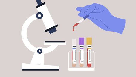 New blood test can detect heart attack and save lives