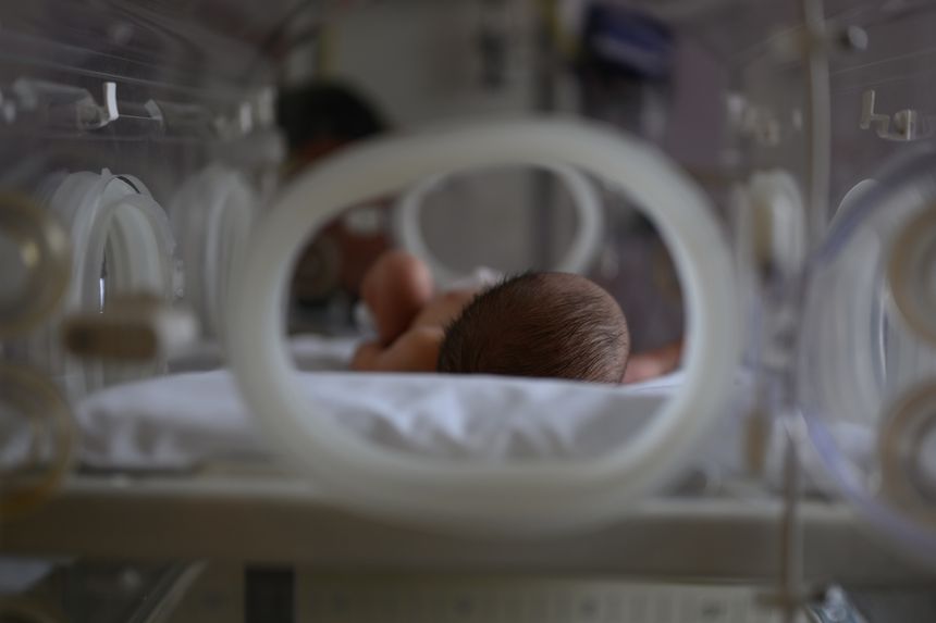 Anonymous newborn baby with hair receiving treatment inside of an incubator