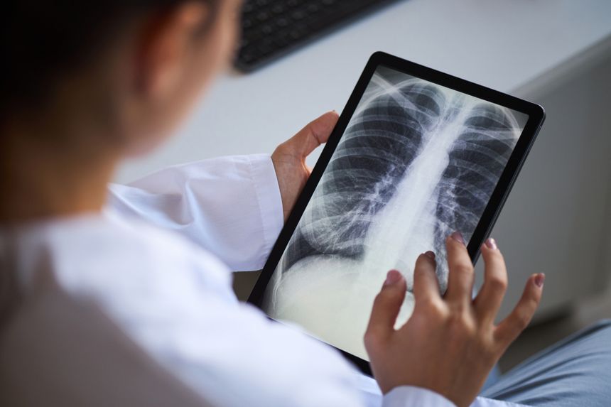 Young adult female doctor examining chest X-ray image on digital tablet, focusing on lung area for cancer diagnosis, sitting at desk in medical office, hand touching screen