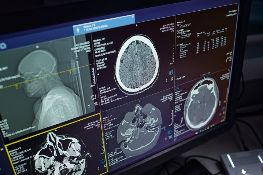 Images display various brain scans on computer screen in modern radiology lab, showing detailed medical imaging of brain anatomy for diagnostic purposes