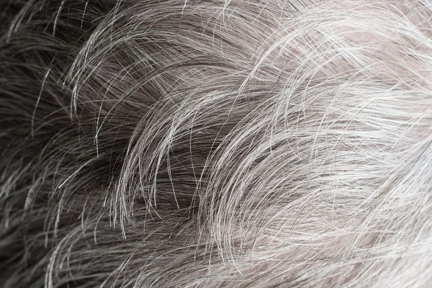 Grey hairs grow when your body shuts down cancer-prone cells, study suggests