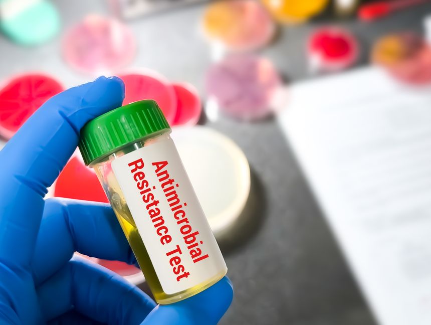AMR or Antimicrobial Resistance test, Microbiological analysis. Antibiotic susceptibility testing.