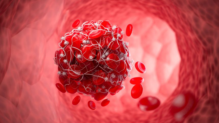 3D illustration of a blood clot, red blood with white blood cells isolate on white background.