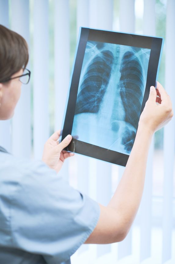 Indicating presence of pneumonia on lungs x-ray image
