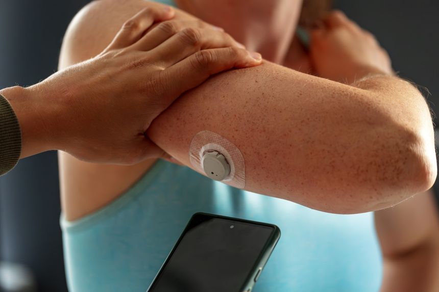 Diabetic young woman with glucose sensor and mobile phone measuring blood sugar level at home