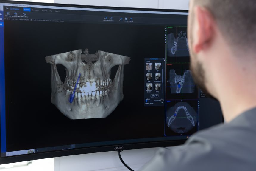A professional analyzes advanced 3D dental imaging displayed on a computer screen, showcasing a detailed view of a dental structure, important for surgical planning and diagnostics.