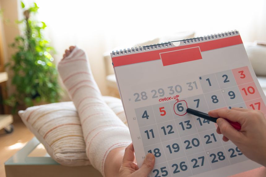 Patient with a broken leg wrapped in a cast marks a date on a calendar for a medical check-up, highlighting the importance of timely healthcare management and recovery