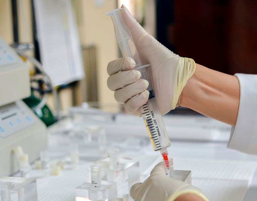 A doctor working on a disheveled lab table, vials strewn about, is drawing up stem cells into a syringe. Stem cells are now in clinical trials for infusion into Long Covid patients.