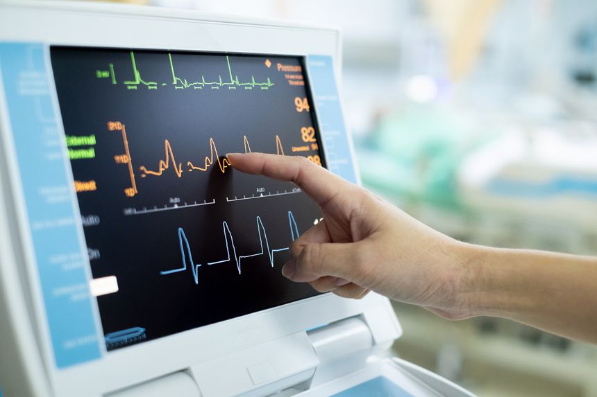 EKG monitor in intra aortic balloon pump machine. Medical equipment