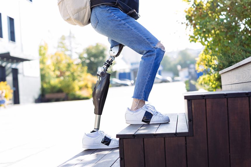 Young woman student with prosthetic leg walking upstairs in city. Disabled woman with prosthetic leg using stairs. Woman with leg prosthesis equipment.