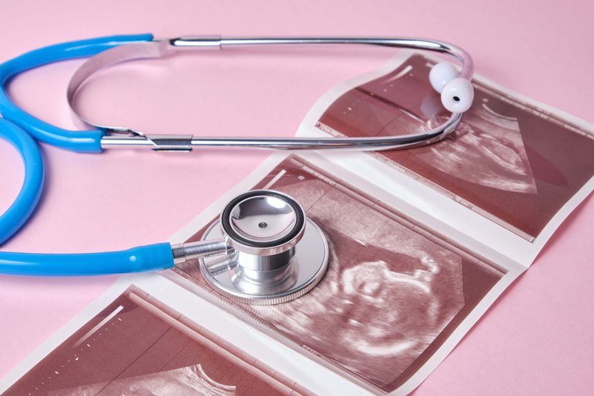 stethoscope and ultrasound scan of embryo on pink background, pregnancy concept