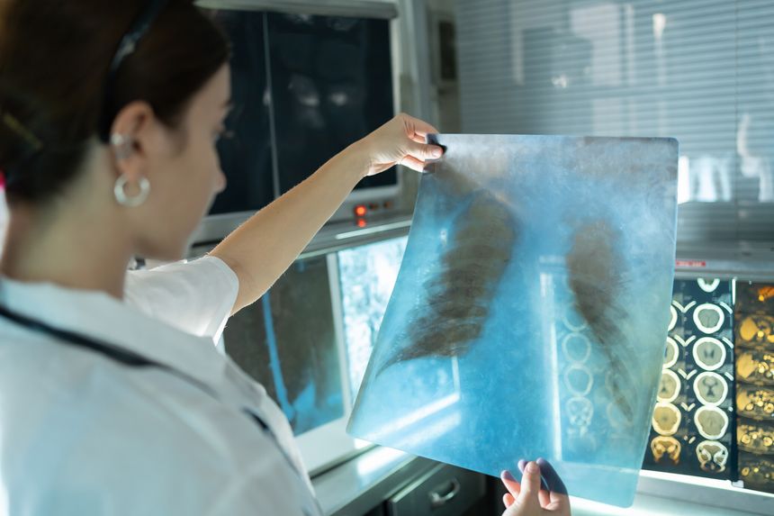 Woman radiology doctor examining chest x-ray film of patient in health care medical laboratory at hospital