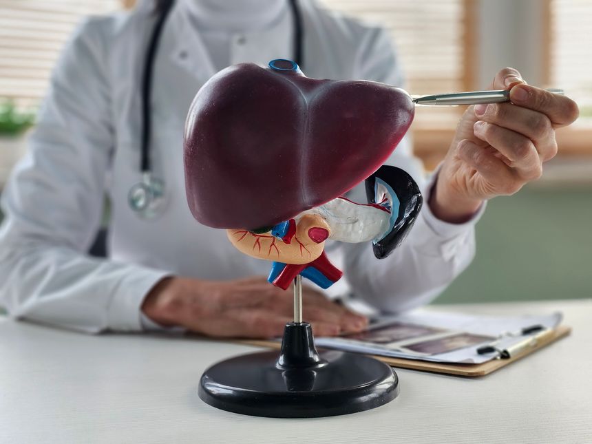 Doctor holding human Liver anatomy model. Liver cancer and Tumor, Jaundice, Viral Hepatitis A, B, C, D, E, Cirrhosis, Failure Enlarged Hepatic